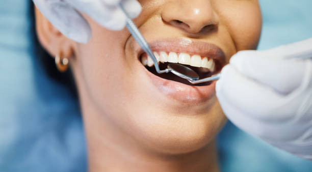 Best Affordable Emergency Dental Care  in Blue Jay, OH