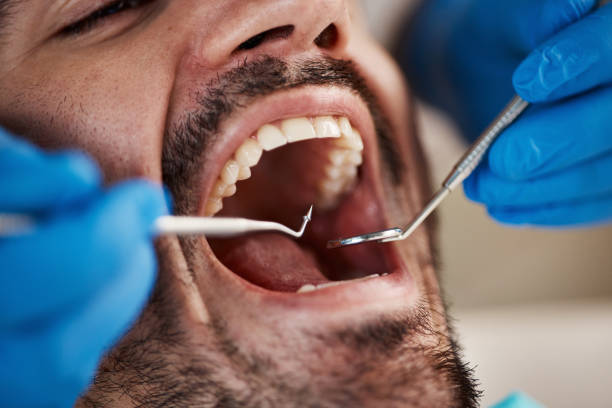 Best Emergency Dental Services Near Me  in Blue Jay, OH